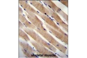 RHEB Antibody (C-term) (ABIN655712 and ABIN2845163) immunohistochemistry analysis in formalin fixed and paraffin embedded human skeletal muscle followed by peroxidase conjugation of the secondary antibody and DAB staining. (RHEB Antikörper  (C-Term))
