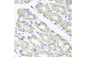 Immunohistochemistry of paraffin-embedded human gastric using SPICE1 antibody at dilution of 1:100 (x40 lens). (SPICE1 Antikörper)