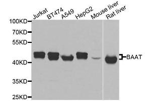 Western blot analysis of extracts of various cell lines, using BAAT antibody. (BAAT Antikörper  (AA 309-418))