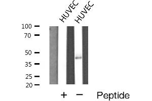 Western blot analysis of Cathepsin E expression in HUVEC cells (Cathepsin E Antikörper  (Internal Region))