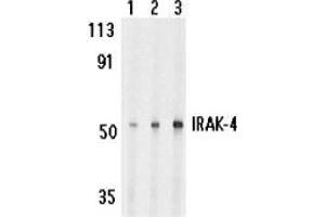 Western blot analysis of IRAK-4 in HeLa cell lysate with AP30442PU-N IRAK-4 antibody at 1 (lane 1), 2 (lane 2), and 4 (lane 3) μg/ml, respectively. (IRAK4 Antikörper)