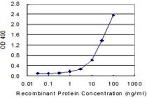 Sandwich ELISA detection sensitivity ranging from 1 ng/mL to 100 ng/mL. (CALD1 (Human) Matched Antibody Pair)