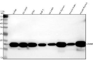 Western blot analysis of Stathmin 1 using anti-Stathmin 1 antibody (ABIN3043301).