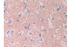 IHC-P analysis of Human Cerebrum Tissue, with DAB staining. (CYP1A2 Antikörper  (AA 2-231))