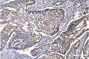IHC analysis of GFPT1 using anti-GFPT1 antibody (ABIN7602887). (GFPT1 Antikörper  (C-Term))