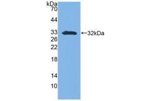 Detection of Recombinant SFN, Mouse using Polyclonal Antibody to Stratifin (SFN) (14-3-3 sigma/SFN Antikörper  (AA 1-249))