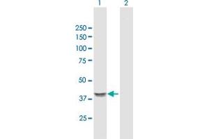 Western Blotting (WB) image for anti-Guanine Nucleotide Binding Protein (G Protein), alpha 14 (GNa14) (AA 1-355) antibody (ABIN948833)