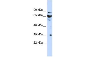 WB Suggested Anti-DCUN1D3 Antibody Titration: 0. (DCUN1D3 Antikörper  (N-Term))