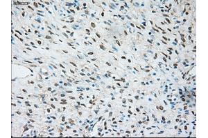 Immunohistochemical staining of paraffin-embedded Kidney tissue using anti-TRPM4mouse monoclonal antibody. (TRPM4 Antikörper)