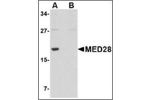 Western blot analysis of MED28 in human brain tissue lysate with this product at 1 μg/ml in (A) the absence and (B) the presence of blocking peptide.