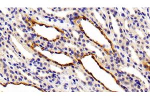 Immunohistochemistry (IHC) image for anti-Keratin 7 (KRT7) (AA 394-457) antibody (ABIN7437020)