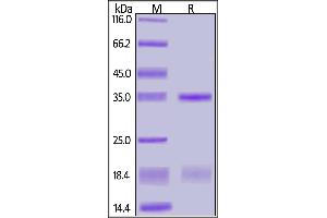 SARS-CoV-2 NSP16&NSP10 Heterodimer Protein, His Tag&Twin Strep Tag on SDS-PAGE under reducing (R) condition.