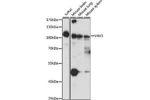 Western blot analysis of extracts of various cell lines, using V antibody  at 1:1000 dilution. (VAV3 Antikörper  (AA 560-680))
