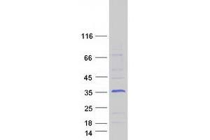 Western Blotting (WB) image for Four and A Half LIM Domains 2 (FHL2) (Transcript Variant 5) protein (Myc-DYKDDDDK Tag) (ABIN2721139)