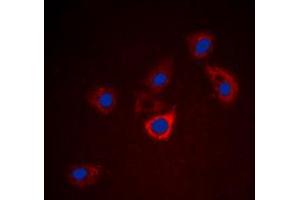 Immunofluorescent analysis of BCL2 staining in HeLa cells. (Bcl-2 Antikörper  (Center))