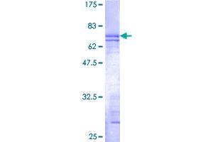 IGBP1 Protein (AA 1-339) (GST tag)