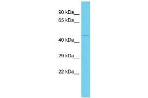 Host: Rabbit Target Name: C10orf88 Sample Type: HCT15 Whole Cell lysates Antibody Dilution: 1. (C10orf88 Antikörper  (C-Term))