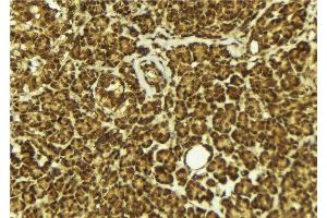 ABIN6279411 at 1/100 staining Mouse pancreas tissue by IHC-P. (NEIL2 Antikörper  (Internal Region))