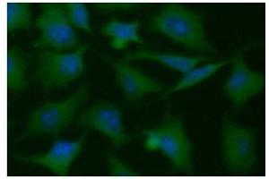 ICC/IF analysis of PGAM1 in HeLa cells line, stained with DAPI (Blue) for nucleus staining and monoclonal anti-human PGAM1 antibody (1:100) with goat anti-mouse IgG-Alexa fluor 488 conjugate (Green). (PGAM1 Antikörper)