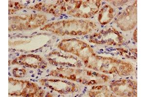 Immunohistochemistry of paraffin-embedded human kidney tissue using ABIN7159169 at dilution of 1:100 (Medium-Chain Specific Acyl-CoA Dehydrogenase, Mitochondrial (AA 26-421) Antikörper)