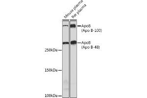 Western blot analysis of extracts of various cell lines, using ApoB Rabbit mAb (ABIN7265635) at 1:1000 dilution. (APOB Antikörper)