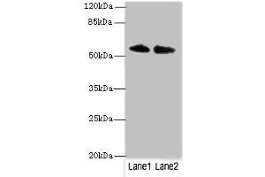 Western blot All lanes: TRIM55 antibody at 1 μg/mL Lane 1: Hela whole cell lysate Lane 2: Mouse liver tissue Secondary Goat polyclonal to rabbit IgG at 1/10000 dilution Predicted band size: 61, 51, 27 kDa Observed band size: 61 kDa