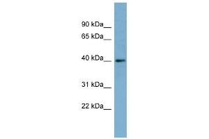 RP2 antibody used at 1 ug/ml to detect target protein.
