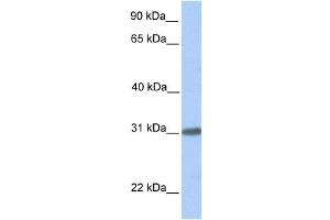 Western Blotting (WB) image for anti-Chromosome 7 Open Reading Frame 61 (C7orf61) antibody (ABIN2459744) (C7orf61 Antikörper)