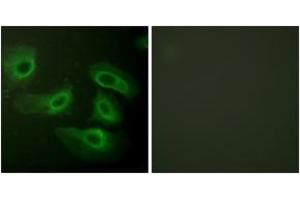 Immunofluorescence analysis of HeLa cells, using Caspase 9 (Ab-196) Antibody. (Caspase 9 Antikörper  (AA 162-211))