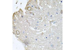 Immunohistochemistry (Paraffin-embedded Sections) (IHC (p)) image for anti-Coiled-Coil-Helix-Coiled-Coil-Helix Domain Containing 3 (CHCHD3) (AA 1-227) antibody (ABIN6138492)