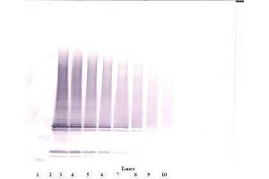 Image no. 1 for anti-Interleukin 17F (IL17F) antibody (ABIN465701) (IL17F Antikörper)