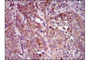 Immunohistochemistry (IHC) image for anti-CD33 (CD33) (AA 15-237) antibody (ABIN1845398) (CD33 Antikörper  (AA 15-237))