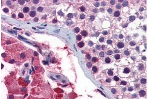 Immunohistochemistry (Formalin-fixed Paraffin-embedded Sections) (IHC (fp)) image for anti-Guanine Nucleotide Binding Protein (G Protein), Q Polypeptide (GNAQ) (AA 71-120) antibody (ABIN6747159)