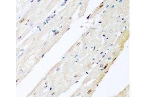 Immunohistochemistry of paraffin-embedded Rat heart using VCP Polyclonal Antibody at dilution of 1:200 (40x lens). (VCP Antikörper)