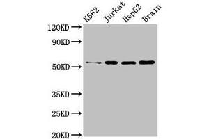 Western Blot Positive WB detected in: K562 whole cell lysate, Jurkat whole cell lysate, HepG2 whole cell lysate, Mouse brain tissue All lanes: SLC16A8 antibody at 3 μg/mL Secondary Goat polyclonal to rabbit IgG at 1/50000 dilution Predicted band size: 53 kDa Observed band size: 53 kDa (MCT3 Antikörper  (AA 432-504))