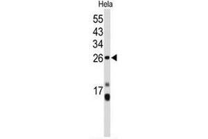 Western blot analysis of CENPH Antibody (Center) in Hela cell line lysates (35µg/lane).