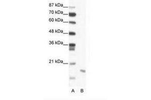 Image no. 1 for anti-Second Mitochondria-Derived Activator of Caspase (DIABLO) (C-Term) antibody (ABIN203000) (DIABLO Antikörper  (C-Term))