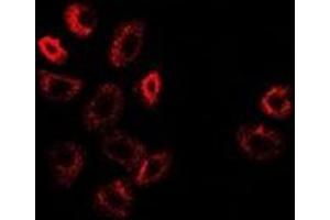 Immunofluorescent analysis of ATF6 staining in A549 cells. (ATF6 Antikörper)