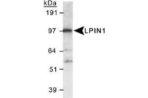 Western blot analysis of LPIN1 in 3T3-L1 lysate using LPIN1 polyclonal antibody . (Lipin 1 Antikörper  (AA 500-600))