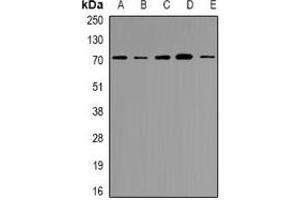 Western blot analysis of NRG1 expression in HEK293T (A), AD293 (B), Hela (C), HepG2 (D), 22RV1 (E) whole cell lysates. (Neuregulin 1 Antikörper  (N-Term))