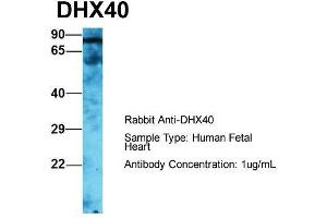DEAH (Asp-Glu-Ala-His) Box Polypeptide 40 (DHX40) (C-Term) Antikörper