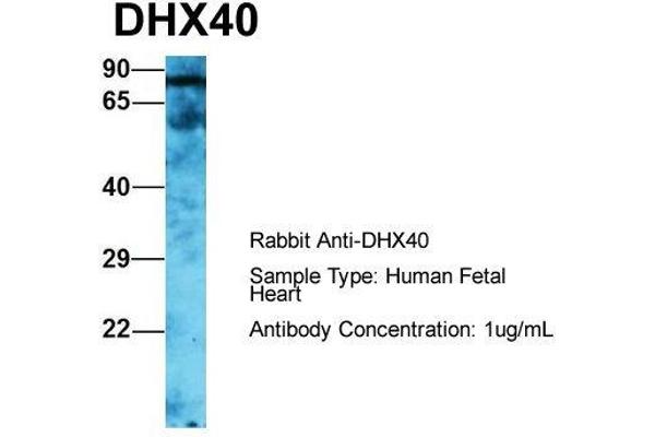 DEAH (Asp-Glu-Ala-His) Box Polypeptide 40 (DHX40) (C-Term) Antikörper