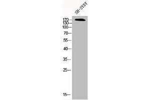 Western Blot analysis of SH-SY5Y cells using CFTR Polyclonal Antibody (CFTR Antikörper)