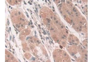 Detection of ATP7b in Human Stomach Tissue using Polyclonal Antibody to ATPase, Cu++ Transporting Beta Polypeptide (ATP7b)