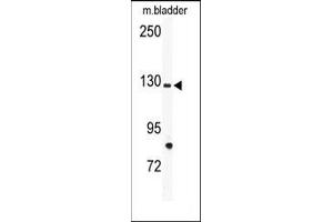Image no. 1 for anti-tyrosine Kinase with Immunoglobulin-Like and EGF-Like Domains 1 (TIE1) (N-Term) antibody (ABIN359947) (TIE1 Antikörper  (N-Term))