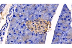 Immunohistochemistry (IHC) image for anti-Caspase 1 (CASP1) (AA 119-296) antibody (ABIN7437506)