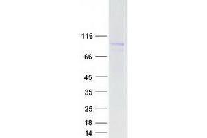 Validation with Western Blot (ZAK Protein (Transcript Variant 1) (Myc-DYKDDDDK Tag))