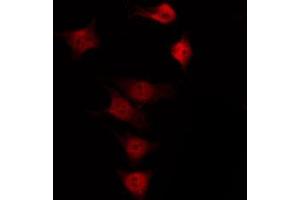 ABIN6266457 staining K562 by IF/ICC. (ENOS Antikörper  (pSer615))