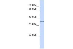 KCNRG antibody used at 1 ug/ml to detect target protein. (KCNRG Antikörper  (Middle Region))