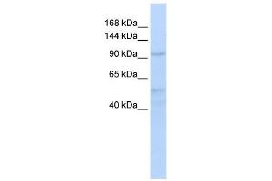 Western Blot showing INTS4 antibody used at a concentration of 1-2 ug/ml to detect its target protein. (INTS4 Antikörper  (Middle Region))